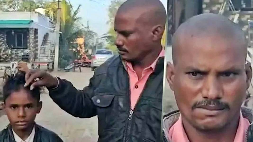 11 köyde yüzlerce kişi sabah kel olarak uyandı! Saç döken gizemli salgının nedeni o olabilir 1